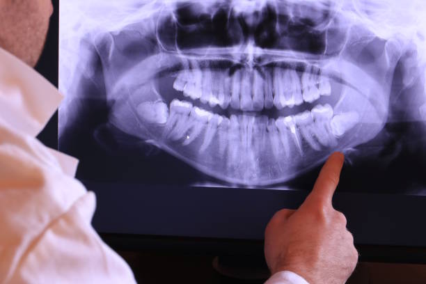 Best Emergency Wisdom Teeth Removal in Wixom, MI