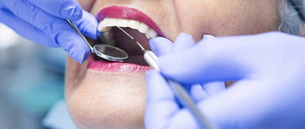 Best Emergency Tooth Extraction in Wixom, MI